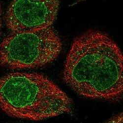 NIPA Antibody, Novus Biologicals 25 &mu;L; Unlabeled:Antibodies, Polyclonal
